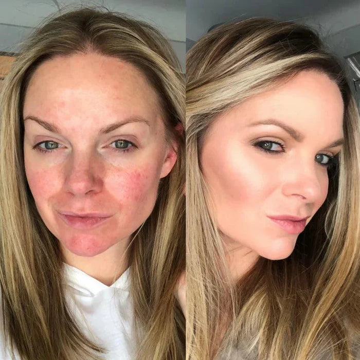 Base Inteligente com Fórmula Rejuvenescedora
