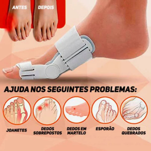 Corretor Articulado De Joanete